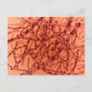 Search for microscopic postcards Magnification