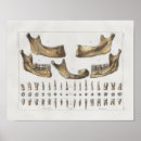 Search for vintage dentist posters Dental