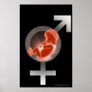 Search for foetus art Reproduction