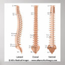 Search for spinal column Chiropractor