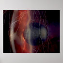 Search for cornea Ophthalmologist