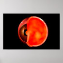Search for ophthalmology posters Anatomy
