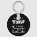 Search for joint key rings Surgery