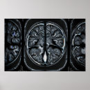 Search for brain anatomy posters Neuroscience