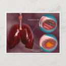 Search for lung postcards Medical