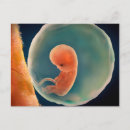 Search for foetus postcards Amniotic sac