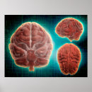 Search for nervous system posters Brain