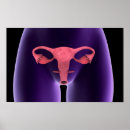 Search for female reproduction posters Uterus