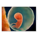 Search for amniotic Amniotic sac