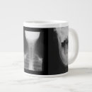 Search for x ray coffee mugs Radiology