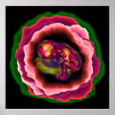 Search for foetus art Childbirth