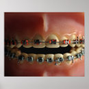 Search for dental posters Braces