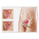 Search for procedures Healthcare