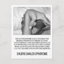 Search for eds postcards Danlos