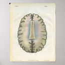 Search for neurology posters Brain