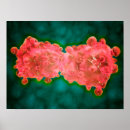 Search for pathological posters Anatomy