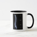 Search for vertebrate mugs Medical