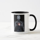 Search for human blood mugs Body