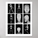 Search for xray art Anatomy