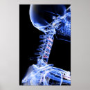 Search for x ray bones posters Image