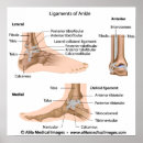 Search for ankles posters Medical