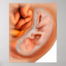 Search for foetus art Development