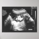 Search for ultrasound posters Sonogram