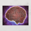 Search for neurological postcards 3d