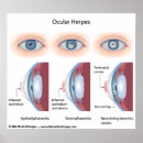 Search for herp posters Virus