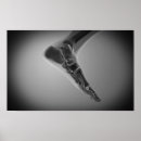 Search for human limb posters Connection
