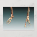 Search for human bones postcards Low section