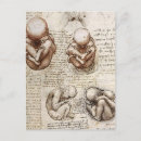 Search for foetus postcards Sketch