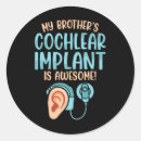 Search for cochlear stickers Implant