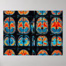 Search for brain anatomy posters Neuroscience