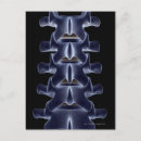 Search for vertebrae postcards Small business