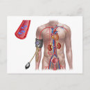 Search for circulatory system postcards Horizontal