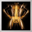 Search for spine chart posters Doctor