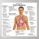 Search for flu art Disease
