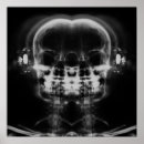 Search for x ray skeleton posters Gifts