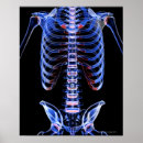 Search for x ray bones posters Rear view