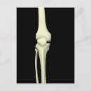 Search for knee postcards Medicine