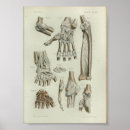 Search for articulation Bones