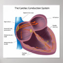 Search for cardiac art Doctor