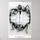 Search for x ray stuff posters Medical