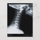 Search for vertebrae postcards Vintage