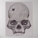 Search for ancient practice Medical
