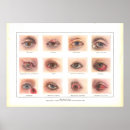 Search for eye chart posters Optometry