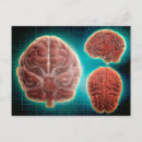 Search for temporal Temporal lobe
