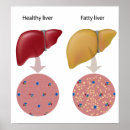 Search for obese posters Anatomy