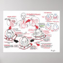 Search for lung anatomy art Alveoli